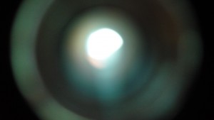 Peephole Close Up